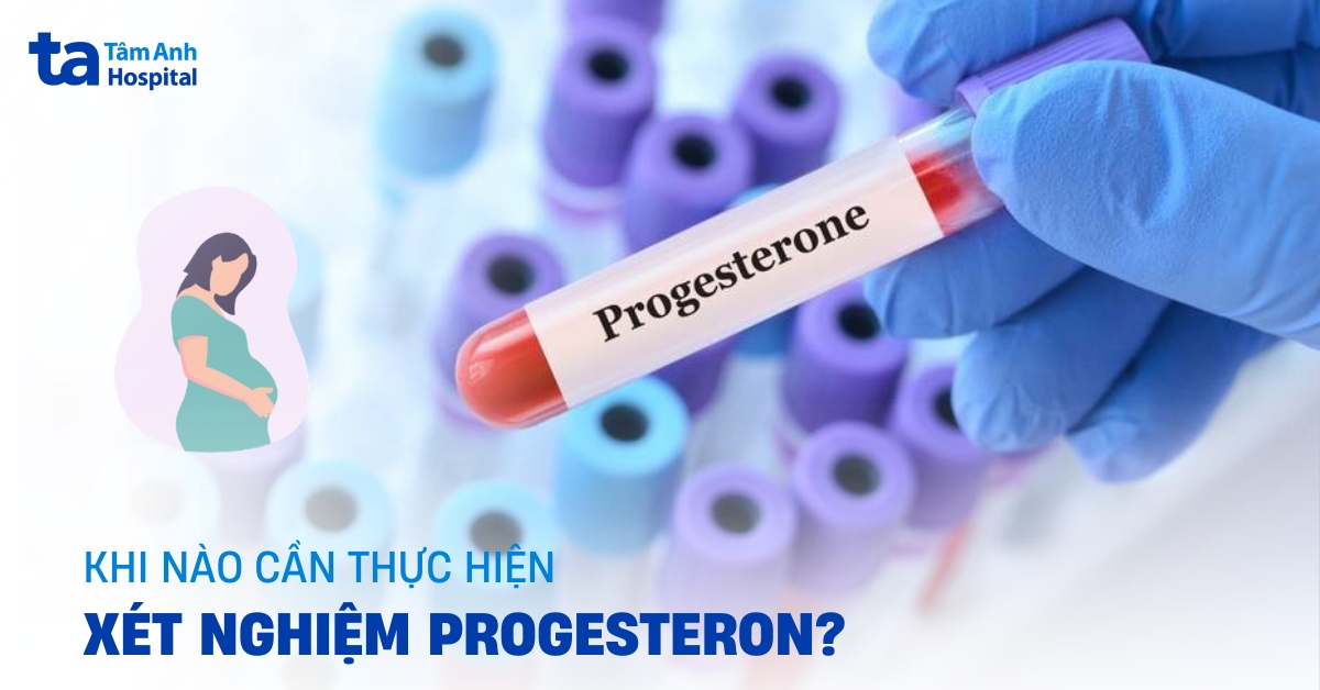 Xet Nghiem Progesterone
