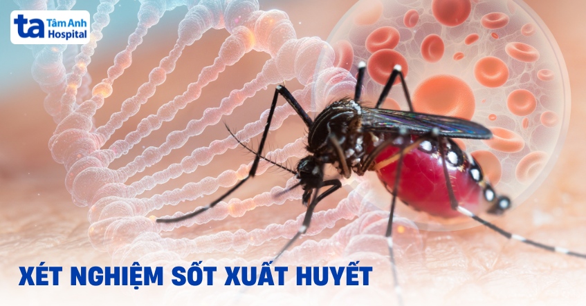 Xet Nghiem Sot Xuat Huyet