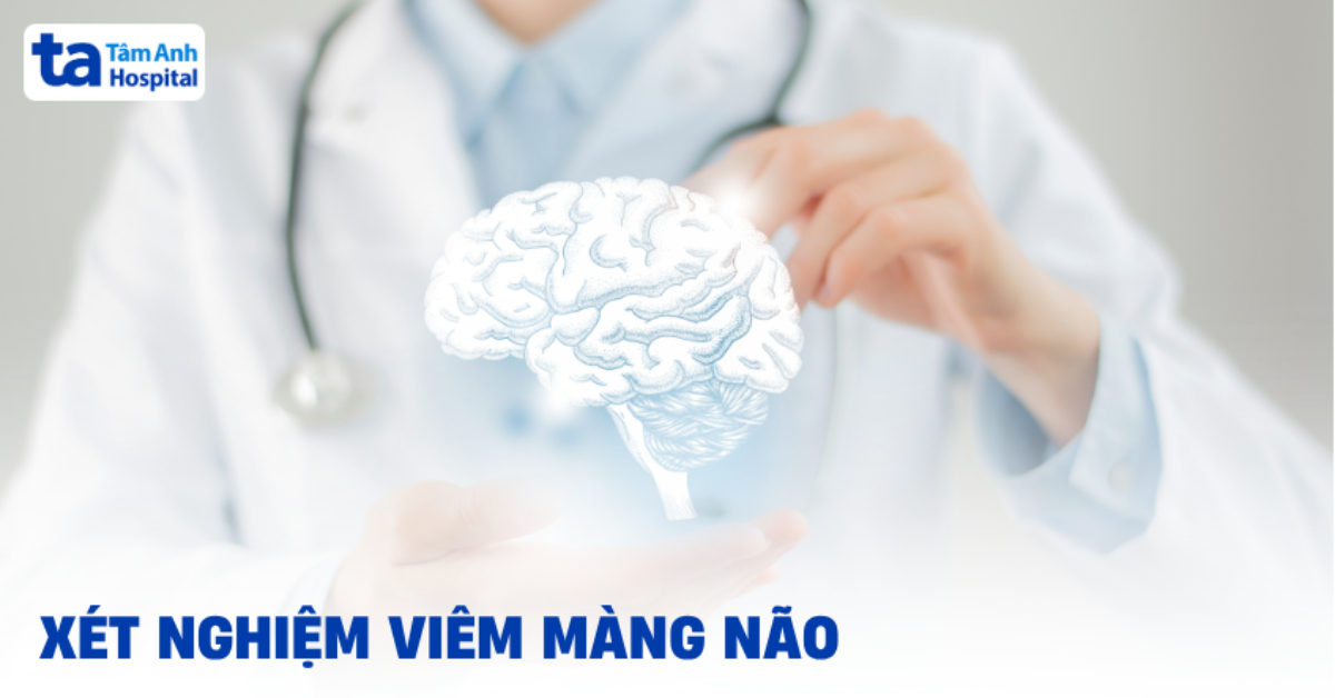 Xet Nghiem Viem Mang Nao