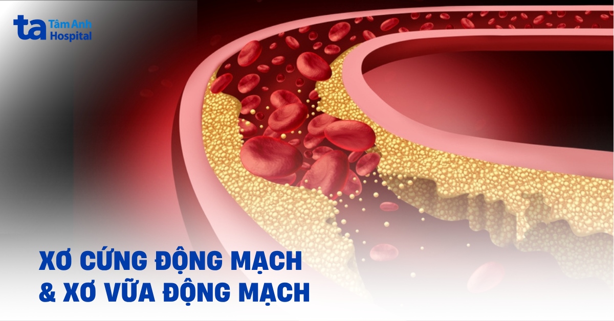 Xo Cung Dong Mach Va Xo Vua Dong Mach